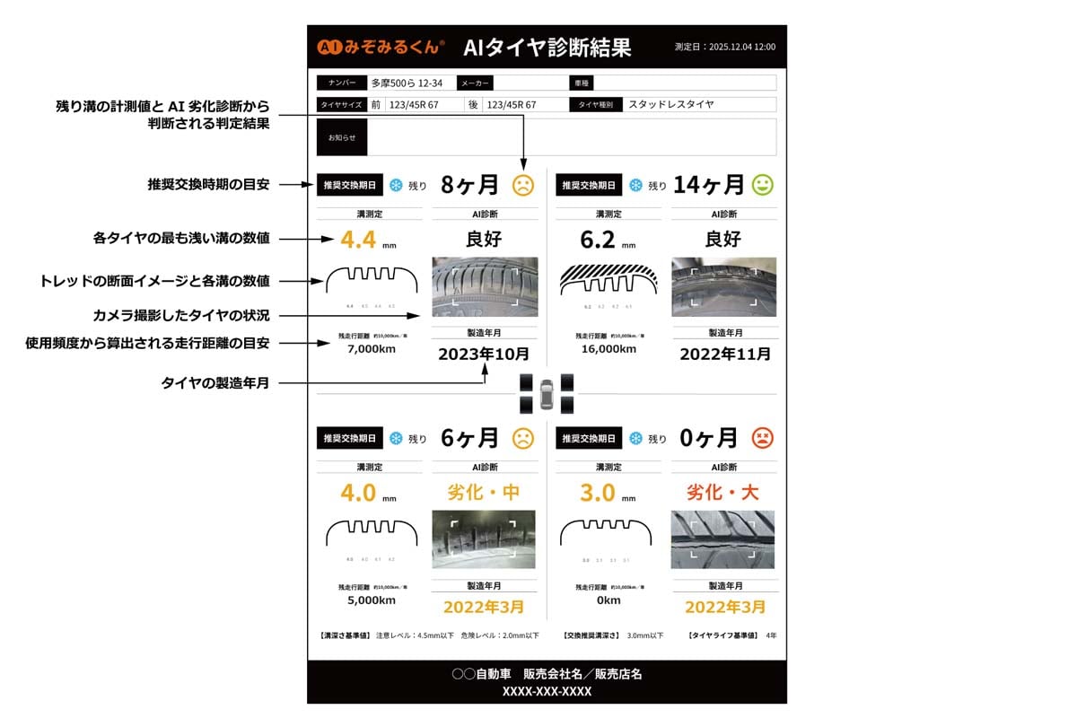 「AIみぞみるくん」のAI診断結果プリントアウト例（画像：パーソナルAVCテクノロジー）